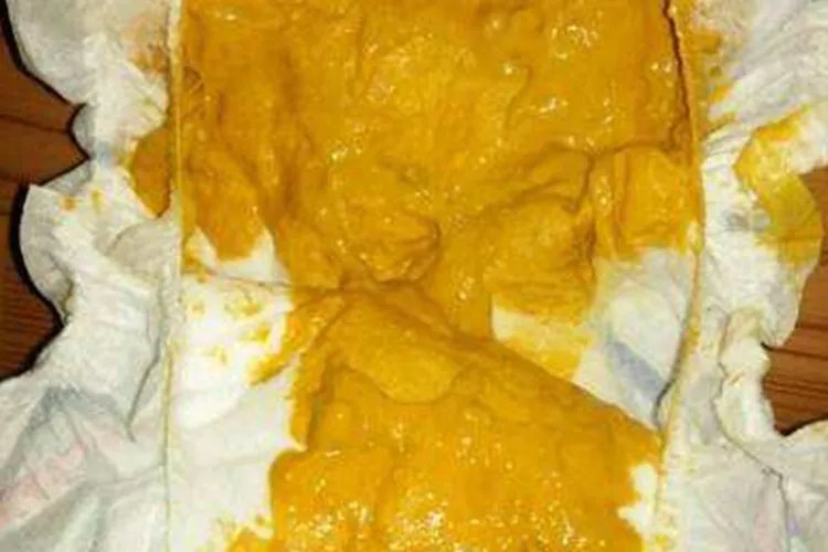 正常新生儿粑粑图片