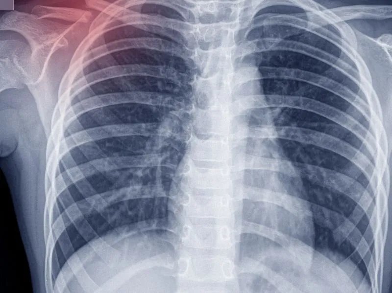 电磁炉是否有辐射