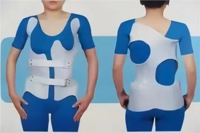 脊柱侧弯矫正支架图片