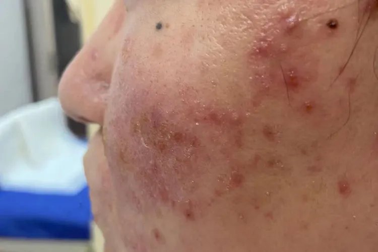 皮肤过敏的图片