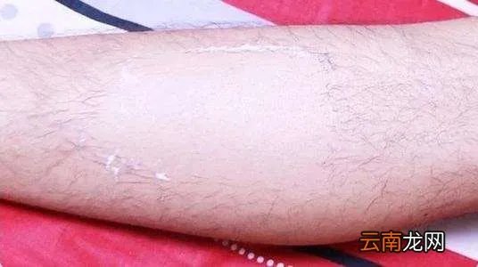 十宗罪中芝麻女孩和玉米男孩,恐怖图片胆小者勿看