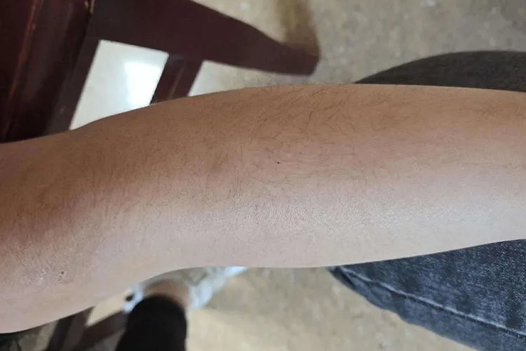 小孩正常汗毛图片