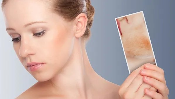 皮肤干燥是什么原因