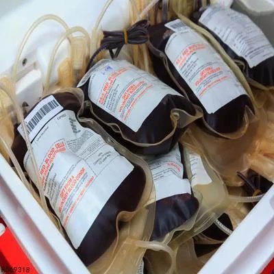 输液不良反应有哪些  输液不良反应的预防方法