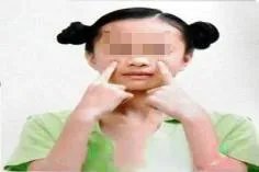 眼保健操的正确做法图解
