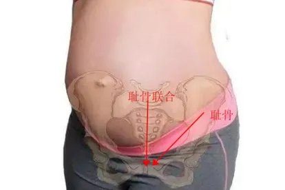孕妇耻骨图片