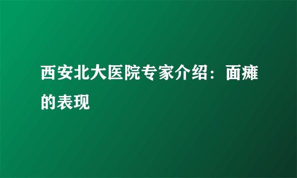西安北大医院专家介绍:面瘫的表现
