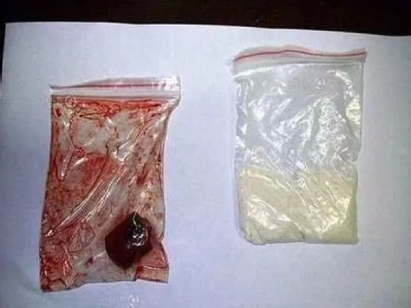 广东碰瓷团用黄鳝血充人血专人演交警是真的吗?