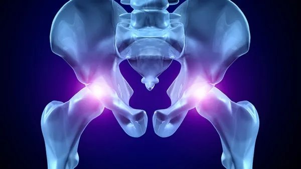 先天性髋关节脱位的原因