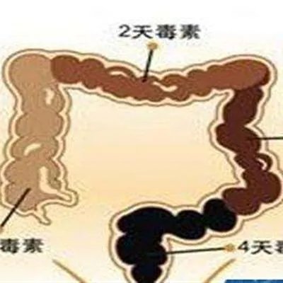 十二指肠球部溃疡是怎么回事?