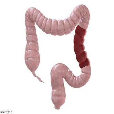 为什么会肠梗阻 得肠梗阻的五个原因揭晓