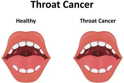 氟骨症患者的注意事项有哪些