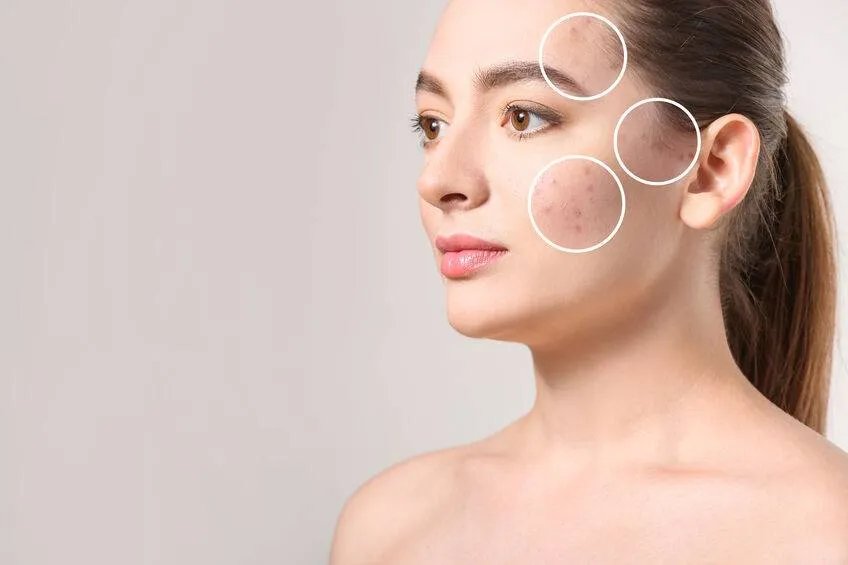 祛斑产品哪款最有效果最安全