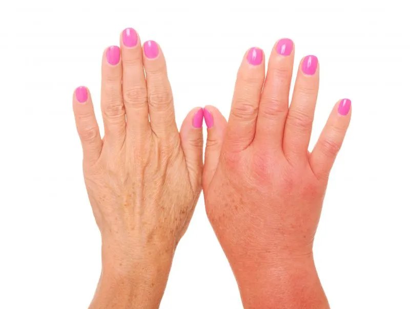 手部去角质的方法