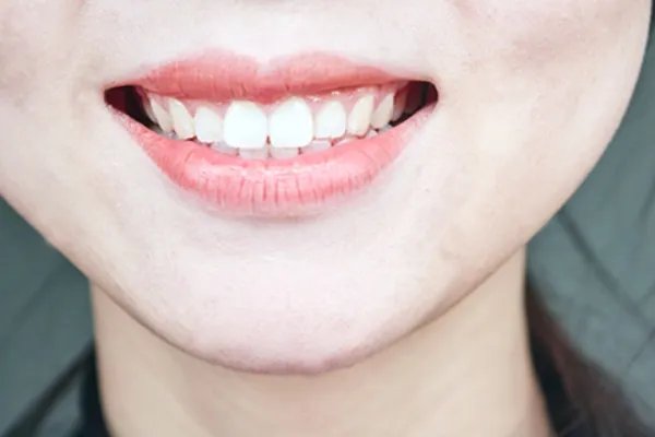 超声波洗牙有什么好处和坏处