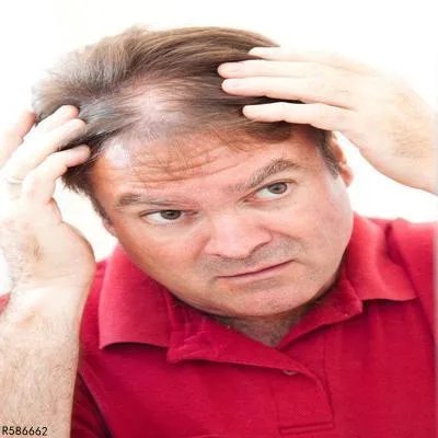 拔毛癖的预防方法有哪些