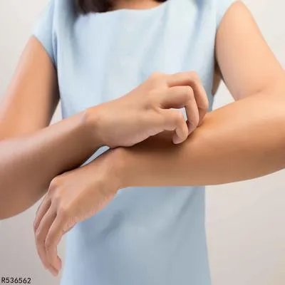 奥硝唑过敏应该怎么办