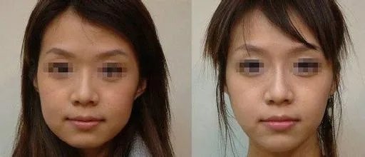 天津光纤溶脂瘦脸手术有哪些靠前的整形美容医院_是你熟悉的医院吗?