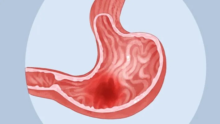 醋泡花生米的功效