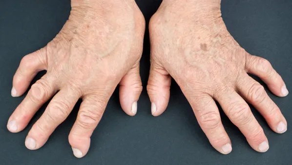 手指甲发白怎么办