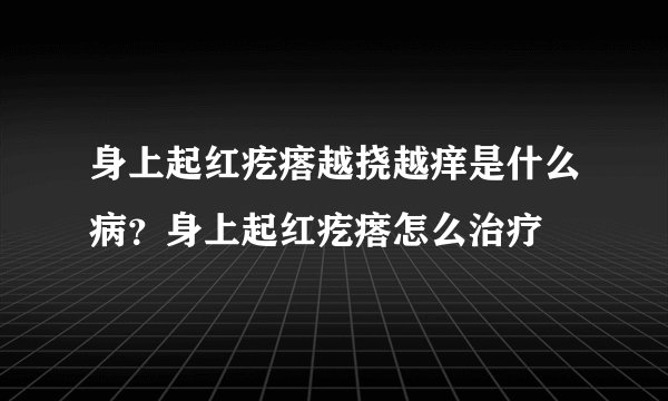 身上起红疙瘩越挠越痒是什么病？身上起红疙瘩怎么治疗