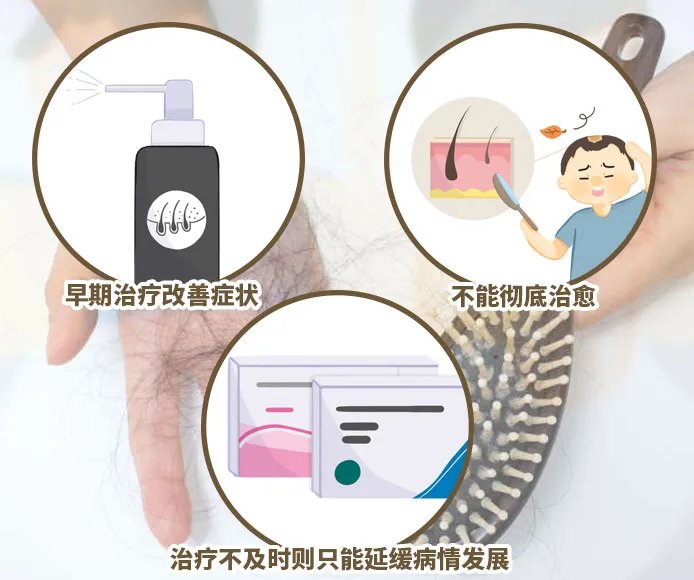 脂溢性脱发可以治愈吗