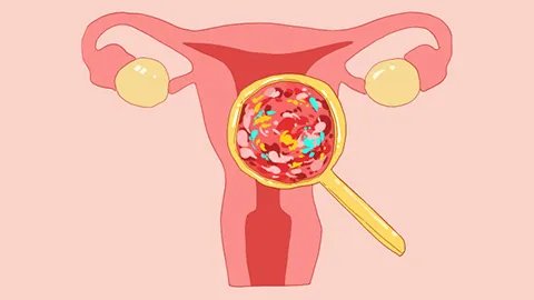 妇科支原体感染如何治疗