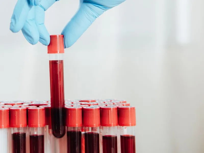 骨髓捐献者有什么影响