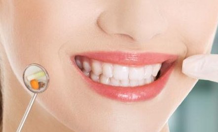 牙齿美容要多少钱