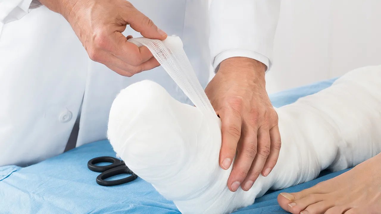 脚踝骨折怎么办