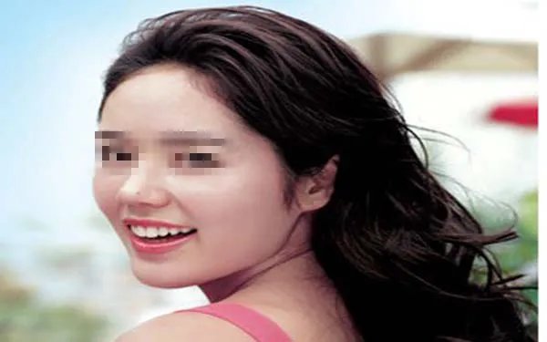 补牙材料价格表有哪些?