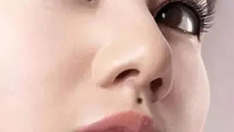 大鼻子整容多少钱