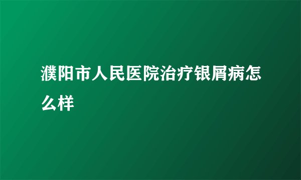 濮阳市人民医院治疗银屑病怎么样