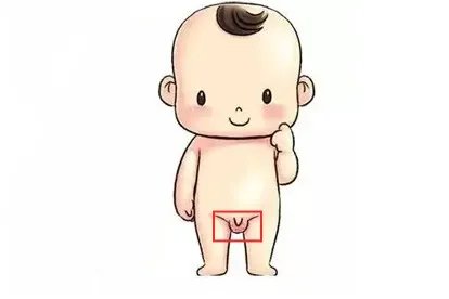 儿童阴囊疥疮结节图片