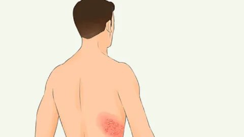 苦楝皮的功效与作用