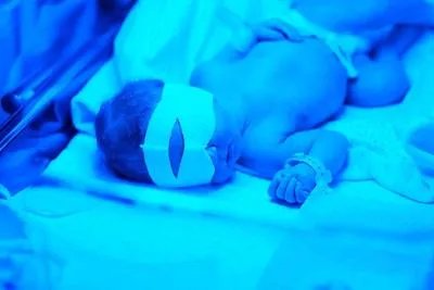 刚刚出生的婴儿黄疸怎么治疗