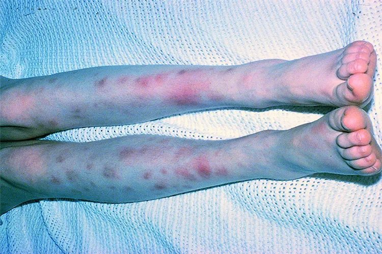 女性长斑的位置图解