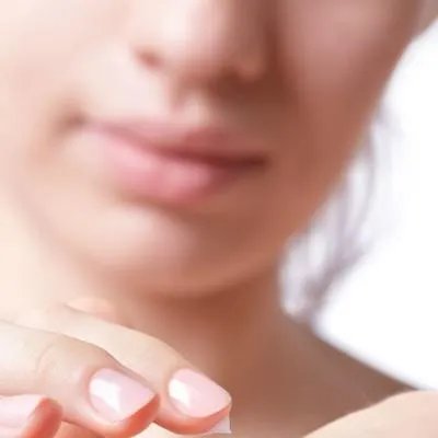 激光祛斑一次多少钱