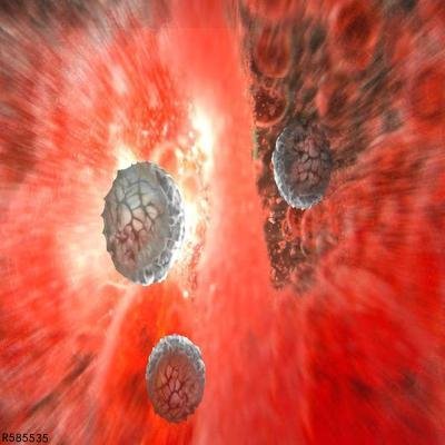 弥漫性血管内凝血怎么办