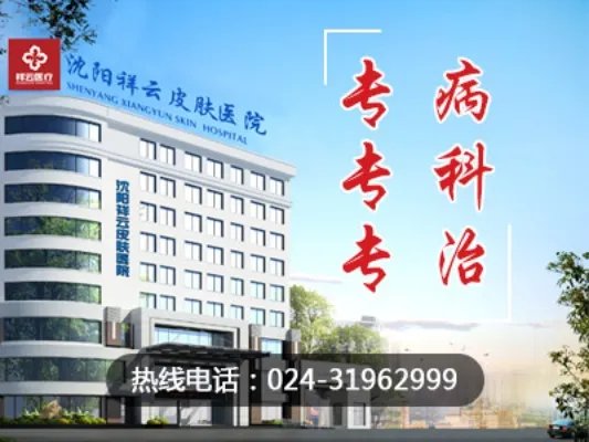 沈阳皮肤病专科医院治疗荨麻疹