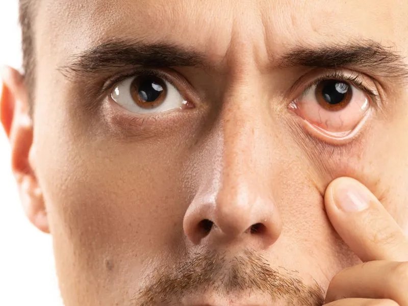 眼科ubm检查是什么