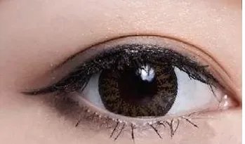 如何预防上眼睑下垂