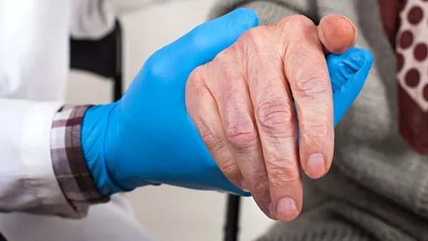 手指脱皮是什么原因?听医生讲