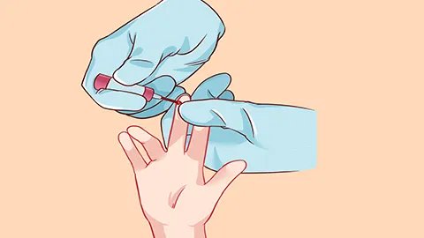 o型血和ab型血生出来的孩子是什么血型