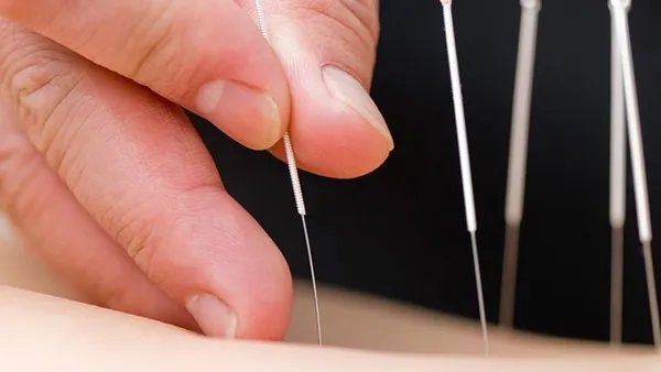 韧带拉伤怎么办