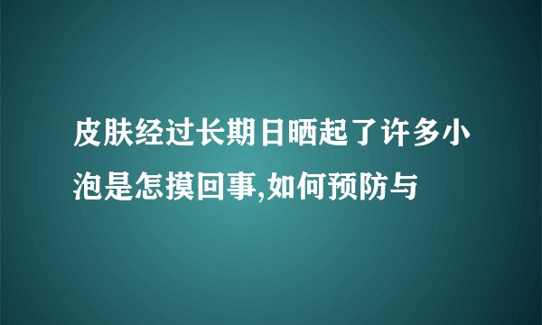 皮肤经过长期日晒起了许多小泡是怎摸回事,如何预防与