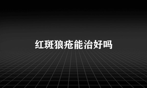 红斑狼疮能治好吗