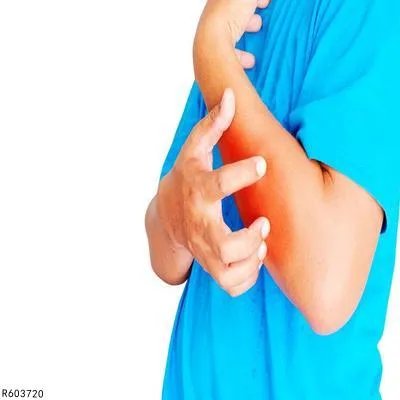 蚊虫叮咬红肿用什么药膏