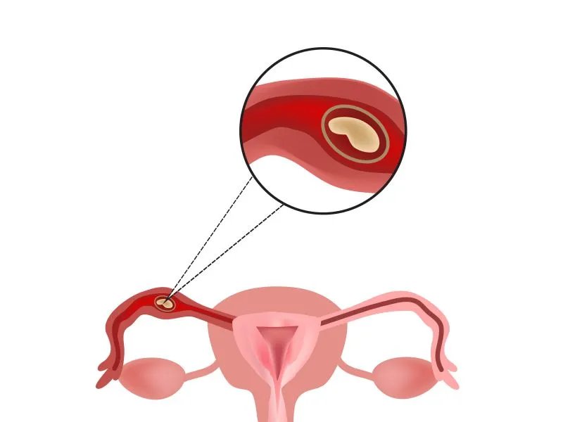 妊娠期是什么意思