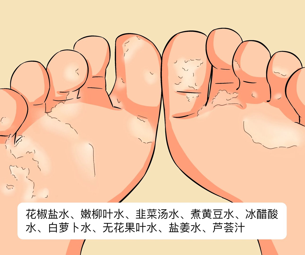 治疗脚气的9个民间偏方